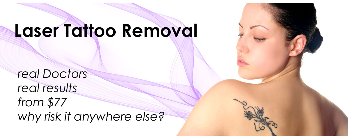 Laser Tattoo Removal machine